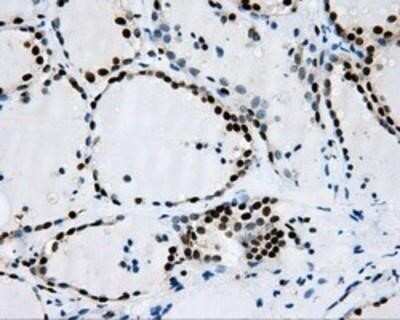 Immunohistochemistry: RPA2 Antibody (OTI9A1) - Azide and BSA Free [NBP2-73935] - Staining of paraffin-embedded Human thyroid tissue using anti-RPA2 mouse monoclonal antibody.