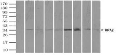 Immunoprecipitation: RPA2 Antibody (OTI9A1) - Azide and BSA Free [NBP2-73935] - (Negative control: IP without adding anti-RPA2 antibody.). For each experiment, 500ul of DDK tagged RPA2 overexpression lysates (at 1:5 dilution with HEK293T lysate), 2ug of anti-RPA2 antibody and 20ul (0.1mg) of goat anti-mouse conjugated magnetic beads were mixed and incubated overnight. After extensive wash to remove any non-specific binding, the immuno-precipitated products were analyzed with rabbit anti-DDK polyclonal antibody.