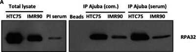 Western Blot: RPA2 Antibody (OTI9A1) - Azide and BSA Free [NBP2-73935] - Ajuba associates with RPA in HTC75 and IMR90 cells. IP-Western probed with a total anti-RPA32 antibody after immunoprecipitation with a commercial anti-Ajuba antibody (com.) or anti-peptide serum from IMR90 or HTC75 extracts as indicated. Left panel: tota