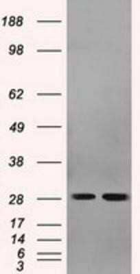 Western Blot: RPA2 Antibody (OTI9A1) - Azide and BSA Free [NBP2-73935] - HEK293T cells were transfected with the pCMV6-ENTRY control (Left lane) or pCMV6-ENTRY RPA2 (Right lane) cDNA for 48 hrs and lysed. Equivalent amounts of cell lysates (5 ug per lane) were separated by SDS-PAGE and immunoblotted with anti-RPA2.