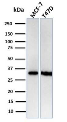 Western Blot: RPA2 Antibody (RPA2/3140R) - Azide and BSA Free [NBP3-08330] - Western Blot Analysis of Human MCF-7, T47D cell lysates using RPA2 Recombinant Rabbit Monoclonal Antibody (RPA2/3140R).