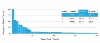 Protein Array: RPA2 Antibody (RPA2/4774) - Azide and BSA Free [NBP3-14167] - Analysis of Protein Array containing more than 19,000 full-length human proteins using RPA2 Antibody (RPA2/4774).