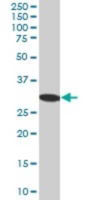 Western Blot: RPA2 Antibody [H00006118-B01P] - Analysis of RPA2 expression in human kidney.