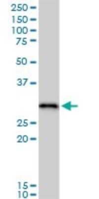 Western Blot: RPA2 Antibody [H00006118-B01P] - Analysis of RPA2 expression in human stomach.