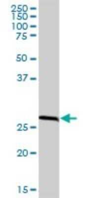 Western Blot: RPA2 Antibody [H00006118-B01P] - Analysis of RPA2 expression in human placenta.