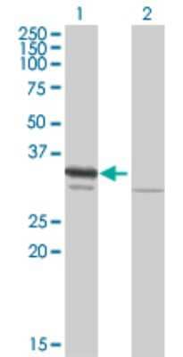 Western Blot: RPA2 Antibody [H00006118-B01P] - Analysis of RPA2 expression in transfected 293T cell line by RPA2 polyclonal antibody.  Lane 1: RPA2 transfected lysate(29.81 KDa). Lane 2: Non-transfected lysate.