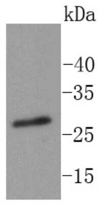 Western Blot: RPA2 [p Thr21] Antibody (SN06-36) [NBP2-67654] - Analysis of RPA32/RPA2 (phospho T21) on Hela cells lysates using anti-RPA32/RPA2 (phospho T21) antibody at 1/1,000 dilution.