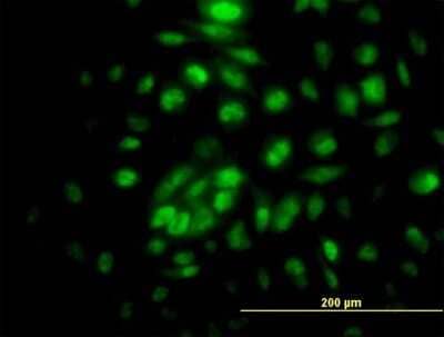 Immunocytochemistry/ Immunofluorescence RPA4 Antibody