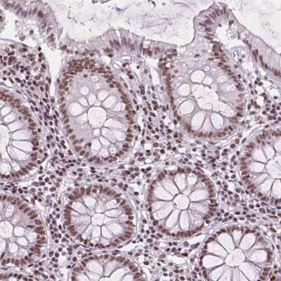 Immunohistochemistry RPA4 Antibody - BSA Free
