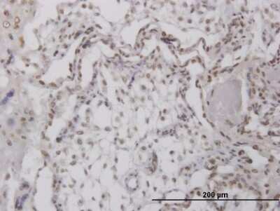 Immunohistochemistry-Paraffin RPA4 Antibody