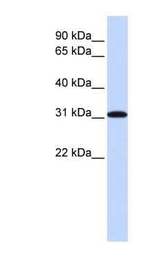 Western Blot: RPA4 Antibody [NBP1-58156] - Hela cell lysate, concentration 0.2-1 ug/ml.