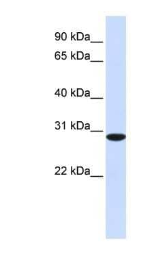 Western Blot: RPA4 Antibody [NBP1-58157] - Human Muscle lysate, concentration 0.2-1 ug/ml.