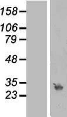 Western Blot: RPA4 Overexpression Lysate (Adult Normal) [NBL1-15491] Left-Empty vector transfected control cell lysate (HEK293 cell lysate); Right -Over-expression Lysate for RPA4.