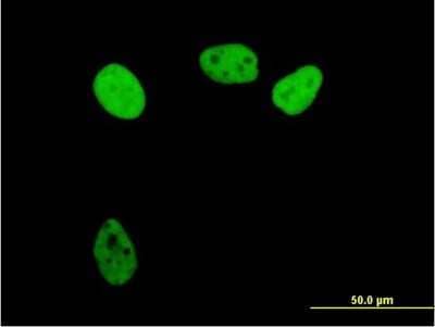 Immunocytochemistry/Immunofluorescence: RPA70 Antibody [H00006117-B01P] - Analysis of purified antibody to RPA1 on HeLa cell. (antibody concentration 10 ug/ml)