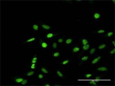Immunocytochemistry/Immunofluorescence: RPA70 Antibody [H00006117-D01P] - Analysis of antibody to RPA1 on HeLa cell. Antibody concentration 10 ug/ml.