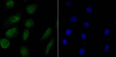 Immunocytochemistry/Immunofluorescence: RPA70 Antibody (JB75-32) [NBP2-75648] - Staining RPA70 in A549 cells (green). The nuclear counter stain is DAPI (blue). Cells were fixed in paraformaldehyde, permeabilised with 0.25% Triton X100/PBS.