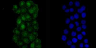 Immunocytochemistry/Immunofluorescence: RPA70 Antibody (JB75-32) [NBP2-75648] - Staining RPA70 in LOVO cells (green). The nuclear counter stain is DAPI (blue). Cells were fixed in paraformaldehyde, permeabilised with 0.25% Triton X100/PBS.