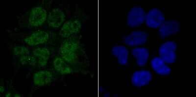 Immunocytochemistry/Immunofluorescence: RPA70 Antibody (JB75-32) [NBP2-75648] - Staining RPA70 in 293T cells (green). The nuclear counter stain is DAPI (blue). Cells were fixed in paraformaldehyde, permeabilised with 0.25% Triton X100/PBS.