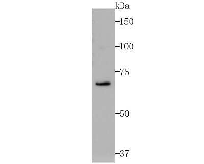 Western Blot: RPA70 Antibody (JB75-32) [NBP2-75648] - Analysis of RPA70 on Siha cell lysates using anti-RPA70 antibody at 1/500 dilution.