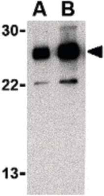 Western Blot: RPAIN Antibody [NBP1-03107] - Western blot of RPAIN in Jurkat cell lysate with RPAIN Antibody at (A) 0.5 and (B) 1 ug/ml.