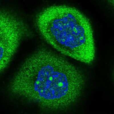 Immunocytochemistry/Immunofluorescence: RPAP2 Antibody [NBP2-13248] - Staining of human cell line A-431 shows positivity in nucleoli and cytoplasm.