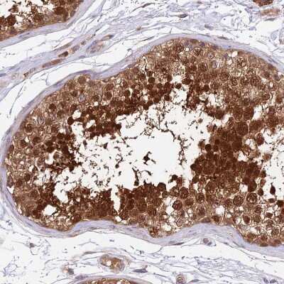 Immunohistochemistry-Paraffin RPAP2 Antibody - BSA Free