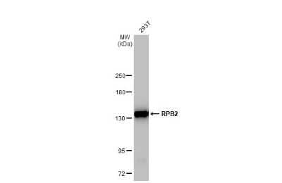 Western Blot: RPB2 Antibody (HL1042) [NBP3-13697] - 293T whole cell extracts (30 ug) was separated by 5% SDS-PAGE, and the membrane was blotted with RPB2 antibody [HL1042] (NBP3-13697) diluted at 1:1000. The HRP-conjugated anti-rabbit IgG antibody (NBP2-19301) was used to detect the primary antibody.