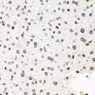 Immunohistochemistry-Paraffin: RPB2 Antibody [NBP2-93593] - Paraffin-embedded mouse liver using RPB2 .