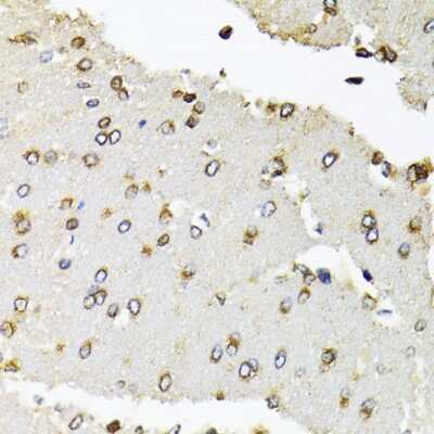 Immunohistochemistry-Paraffin: RPB2 Antibody [NBP2-93593] - Paraffin-embedded rat brain using RPB2 .