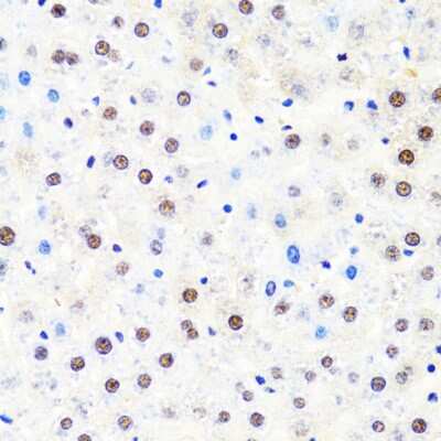 Immunohistochemistry-Paraffin: RPB2 Antibody [NBP2-93593] - Paraffin-embedded rat liver using RPB2 .