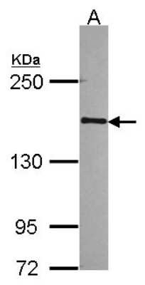 Western Blot: RPB2 Antibody [NBP2-20207] - Sample (30 ug of whole cell lysate) A: 293T 5% SDS PAGE gel, diluted at 1:1000.