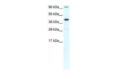 Western Blot: RPB2 Antibody [NBP2-88175] - WB Suggested Anti-POLR2B Antibody Titration: 0.2-1 ug/ml. Positive Control: Human Muscle