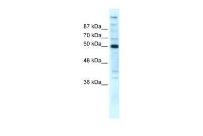 Western Blot: RPB2 Antibody [NBP2-88176] - WB Suggested Anti-POLR2B Antibody Titration: 5ug/ml. Positive Control: HepG2 cell lysate