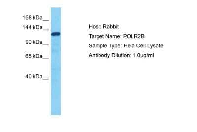 Western Blot: RPB2 Antibody [NBP2-88177] - Host: Rabbit. Target Name: POLR2B. Sample Tissue: Human Hela Whole Cell lysates. Antibody Dilution: 1ug/ml