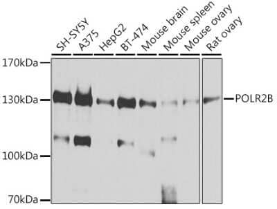 Western Blot: RPB2 Antibody [NBP2-93593] - Analysis of extracts of various cell lines, using RPB2 at 1:1000 dilution. Secondary antibody: HRP Goat Anti-Rabbit IgG (H+L) at 1:10000 dilution. Lysates/proteins: 25ug per lane. Blocking buffer: 3% nonfat dry milk in TBST. Detection: ECL Basic Kit . Exposure time: 10s.
