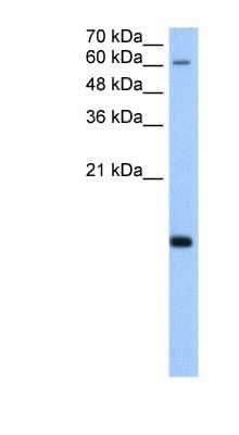 Western Blot: RPB8 Antibody [NBP1-53016] - HepG2 cell lysate, concentration 5.0ug/ml.