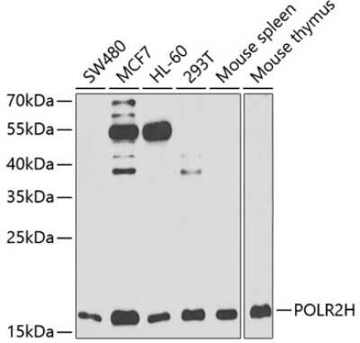 Western Blot: RPB8 Antibody [NBP2-93995] - Analysis of extracts of various cell lines, using RPB8 at 1:1000 dilution. Secondary antibody: HRP Goat Anti-Rabbit IgG (H+L) at 1:10000 dilution. Lysates/proteins: 25ug per lane. Blocking buffer: 3% nonfat dry milk in TBST. Detection: ECL Basic Kit . Exposure time: 30s.