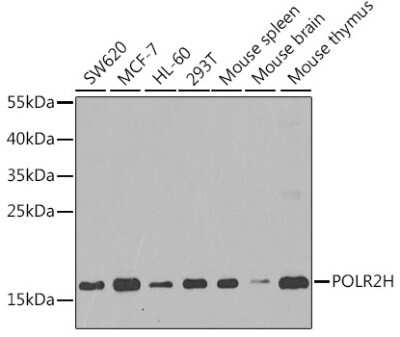 Western Blot: RPB8 Antibody [NBP2-95227] - Analysis of extracts of various cell lines, using RPB8 at 1:1000 dilution. Secondary antibody: HRP Goat Anti-Rabbit IgG (H+L) at 1:10000 dilution. Lysates/proteins: 25ug per lane. Blocking buffer: 3% nonfat dry milk in TBST. Detection: ECL Basic Kit . Exposure time: 30s.