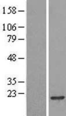 Western Blot: RPB8 Overexpression Lysate (Adult Normal) [NBL1-14585] Left-Empty vector transfected control cell lysate (HEK293 cell lysate); Right -Over-expression Lysate for RPB8.