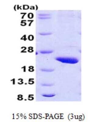 SDS-Page: RPB8 Protein [NBP2-23345]