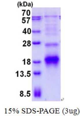 SDS-Page: Recombinant Human RPB9 Protein [NBP2-23346]