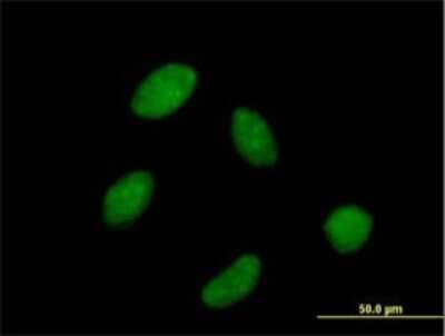 Immunocytochemistry/Immunofluorescence: RPC62 Antibody [H00010623-B03P] - Analysis of purified antibody to POLR3C on HeLa cell. Antibody concentration 10 ug/ml