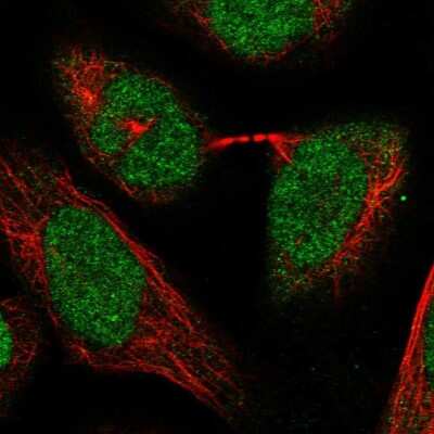 Immunocytochemistry/Immunofluorescence: RPC62 Antibody [NBP1-87110] - Staining of human cell line U-2 OS shows localization to nucleoplasm. Antibody staining is shown in green.