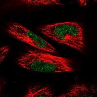 Immunocytochemistry/Immunofluorescence: RPC62 Antibody [NBP1-87111] - Staining of human cell line U-251 MG shows positivity in nucleus but not nucleoli. Antibody staining shown in green.