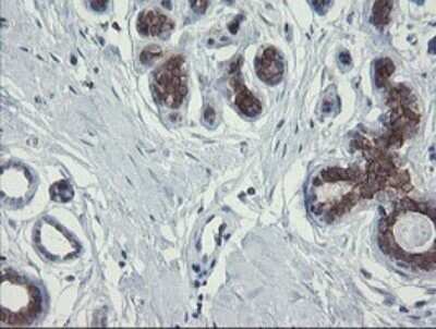 Immunohistochemistry: RPC62 Antibody (OTI2H1) - Azide and BSA Free [NBP2-73942] - Analysis of Human breast tissue.