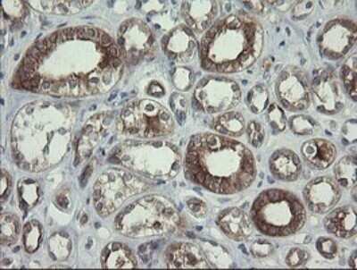 Immunohistochemistry: RPC62 Antibody (OTI2H1) - Azide and BSA Free [NBP2-73942] - Analysis of Human Kidney tissue.
