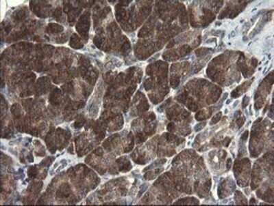 Immunohistochemistry: RPC62 Antibody (OTI2H1) - Azide and BSA Free [NBP2-73942] - Analysis of Human pancreas tissue.