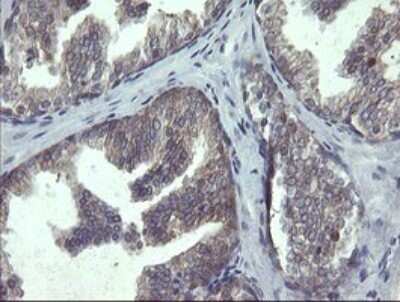 Immunohistochemistry: RPC62 Antibody (OTI2H1) - Azide and BSA Free [NBP2-73942] - Analysis of Human prostate tissue.