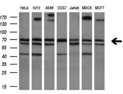 Western Blot: RPC62 Antibody (OTI2H1) - Azide and BSA Free [NBP2-73942] - Analysis of extracts (10ug) from 7 different cell lines (HeLa: human; SVT2: mouse; A549: human; COS7: monkey; Jurkat: human; MDCK: canine; MCF7: Human)