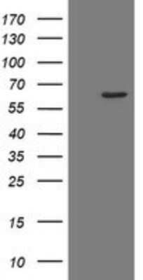 Western Blot: RPC62 Antibody (OTI2H1) - Azide and BSA Free [NBP2-73942] - Analysis of HEK293T cells were transfected with the pCMV6-ENTRY control (Left lane) or pCMV6-ENTRY RPC62.